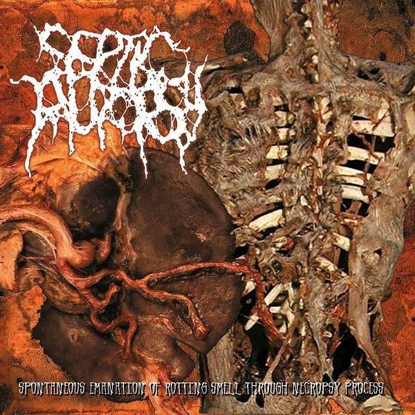 Septic Autopsy - From The Cold Morgue Walls (Intro)