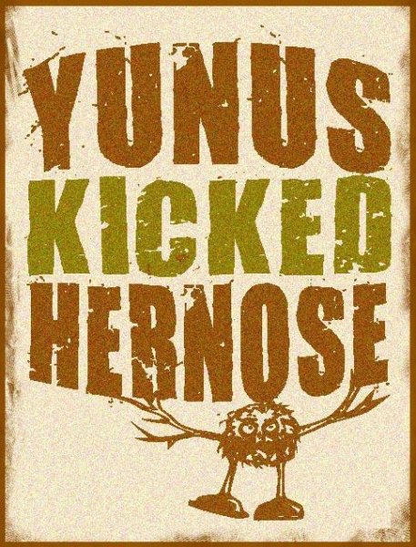 Yunus Kicked Her Nose - The World is Yours