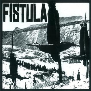 Fistula - Negative