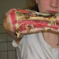 krokodil