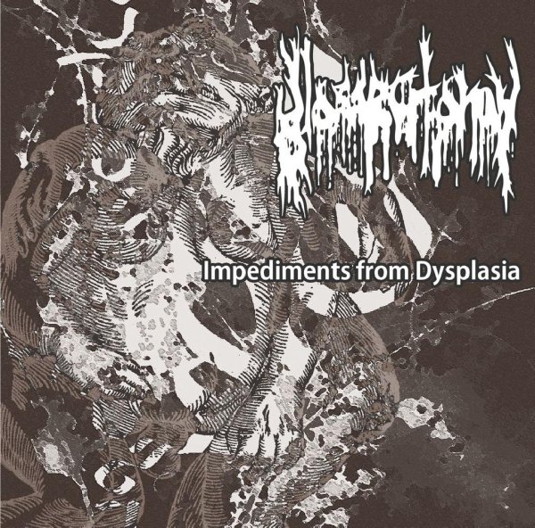 Glossectomy - Infanticide