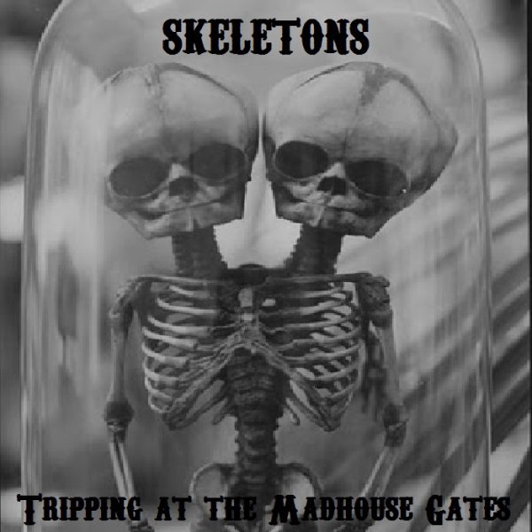 Skeletons - Two-Headed Girl