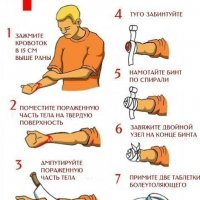 Первая помощь при укусе